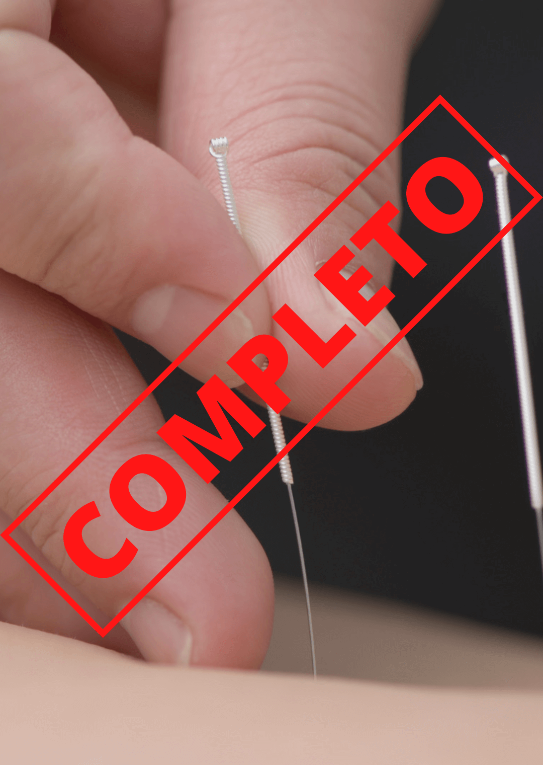¡COMPLETO! XVII Curso ElectroNeuroAcupuntura